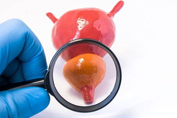 Who Needs HoLEP Surgery