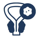 Prostate Cancer Treatment