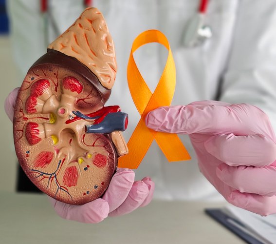 Diagnosis of Kidney Cancer