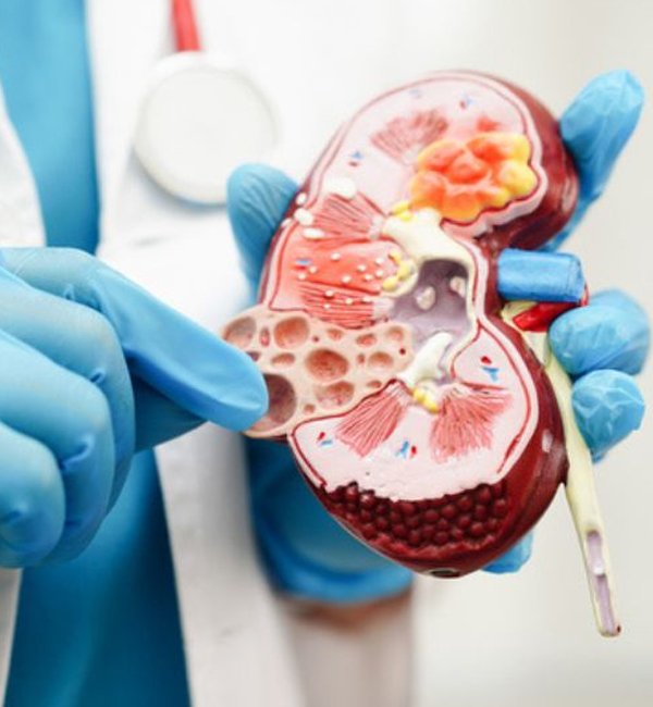 Causes of Kidney Failure