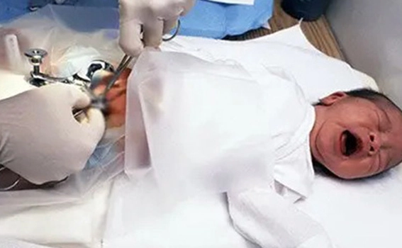 Circumcision in Adults vs Children