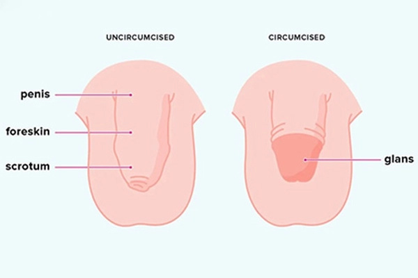 Circumcision Surgery
