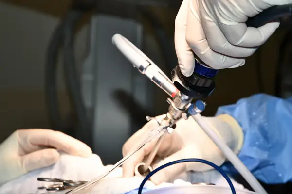 Who Needs Cystolithotomy Surgery