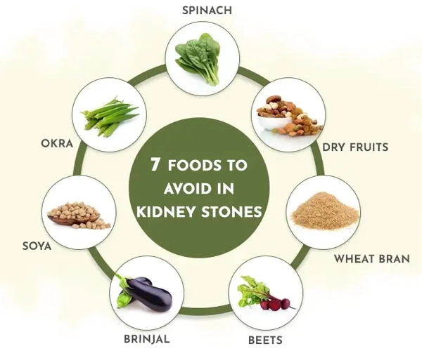 How to Prevent Kidney Stones