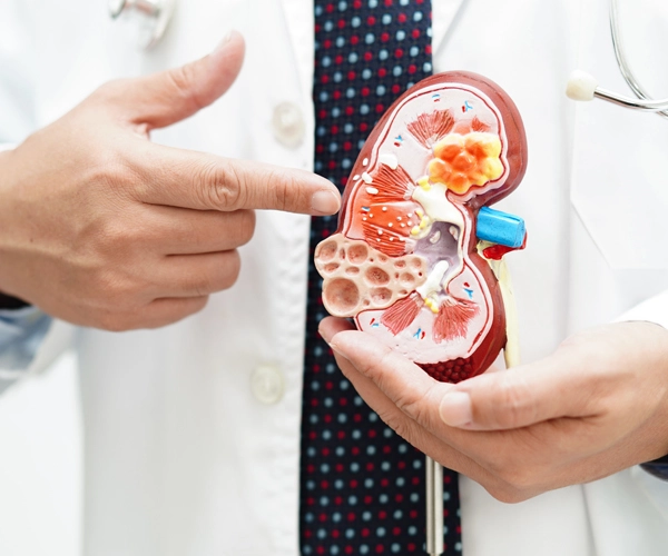 Kidney Stone Treatment Options in Gurgaon