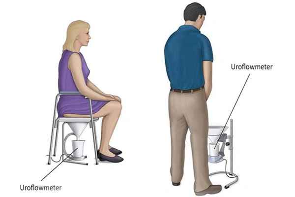 Causes of Enlarged Prostate