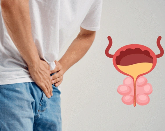 Symptoms of Prostate Enlargement