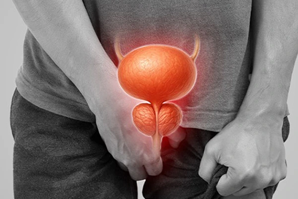 Benefits of Robotic Radical Prostatectomy