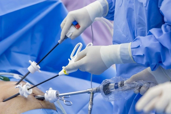 Types of Ureteroplasty Procedures